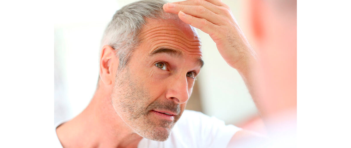 Blog Clínica Vega | Beneficios del plasma rico en plaquetas para la caída del cabello