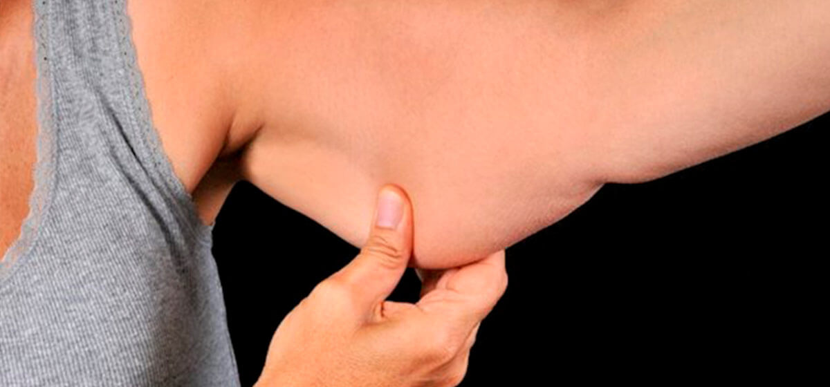 Blog Clínica Vega | Qué podemos hacer con la piel colgante de los brazos